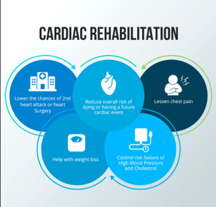 Should you Take Up Cardiac Rehabilitation Programs?